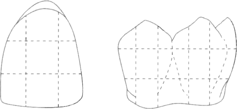 Anterior and posterior tooth diagrams to mark shade zones and details